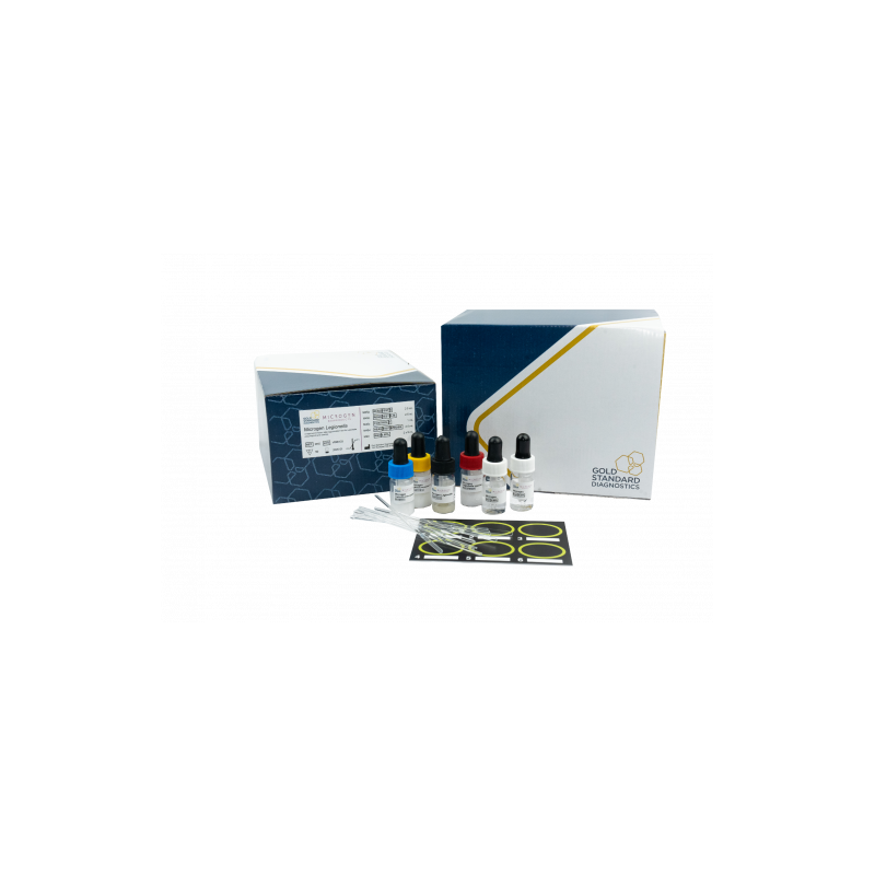 Rapid agglutination latex test Legionella