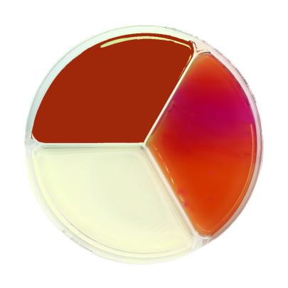 Sabouraud Dextrose Agar / Mannitol Salt Agar / Mac Conkey Agar
