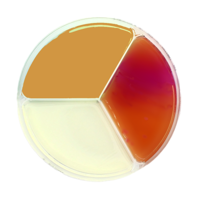 Sabouraud Dextrose Agar / Mannitol Salt Agar / Desoxycholate Citrate Agar