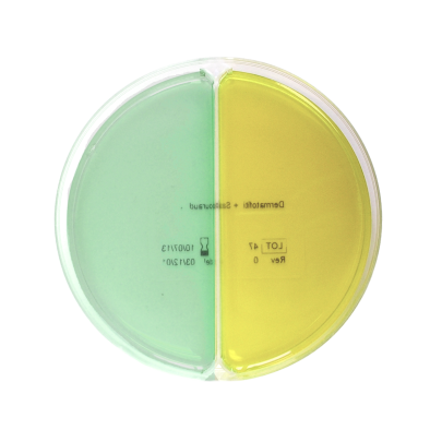 Hektoen Enteric Agar / Salmonella-Shigella (SS) Agar