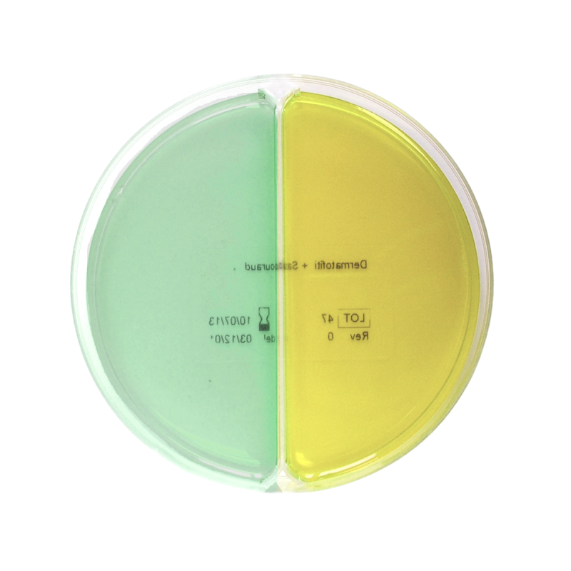 Hektoen Enteric Agar / Salmonella-Shigella (SS) Agar