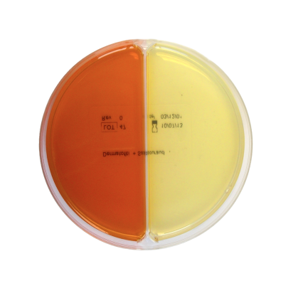 Mac Conkey Agar / Salmonella-Shigella (SS) Agar