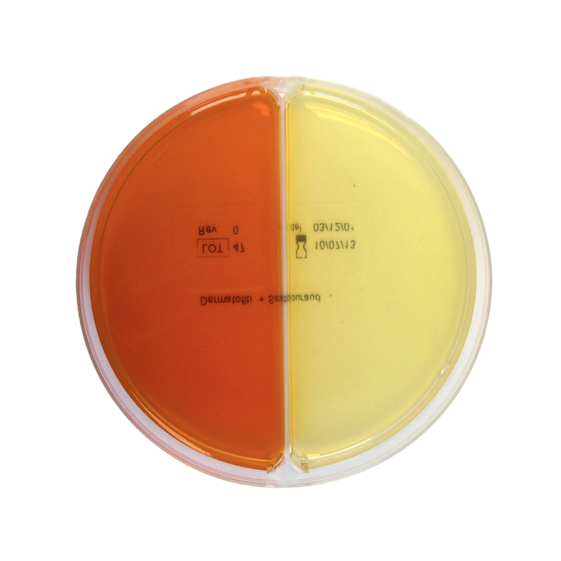 Mac Conkey Agar / Salmonella-Shigella (SS) Agar
