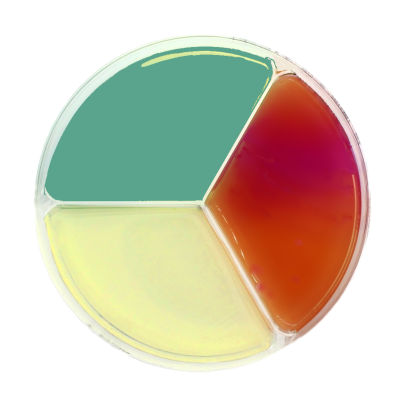 Salmonella-Shigella (SS) Agar / Hektoen Enteric Agar / Mac Conkey Agar