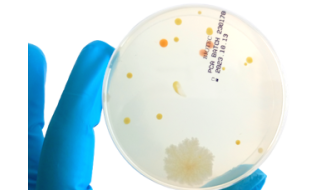 Terreni pronti all'uso per microbiologia
