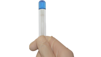 LAL test - Test delle endotossine batteriche